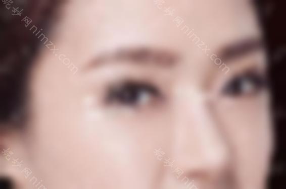 睁开眼角会留下疤痕吗？整形手术后有什么预防措施吗？来看看吧