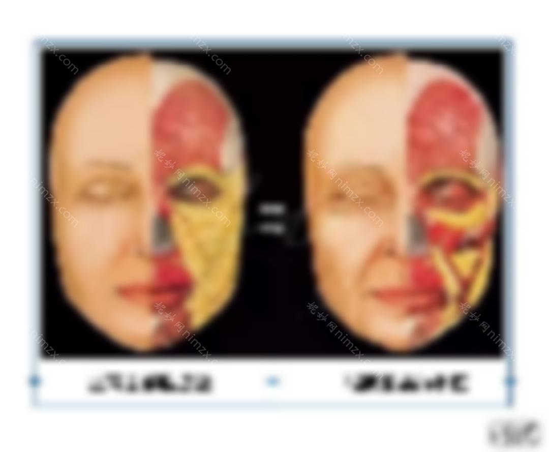 从先天性面部轮廓中寻找抗衰老和抗衰老的秘密