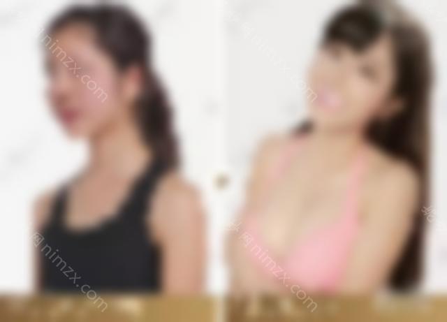 「案例」真人隆胸效果图实拍，隆胸触感与真胸不同？