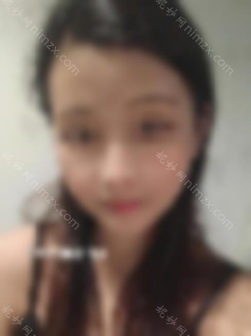 面部轮廓整形包括哪些项目？附上下颌角磨骨真人术前术后比较照片~