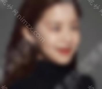 高允真整形前好不好看？内附前后对比图分享~