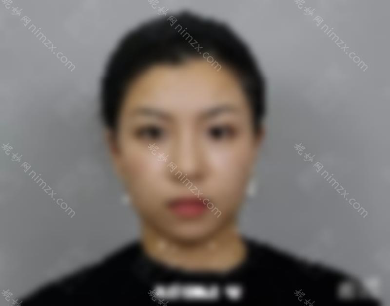 打瘦脸*后，脸塌了？也许你不知道怎么这个？！