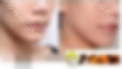 脸颊自体脂肪填充手术会有隐忧吗？如何避免手术风险？