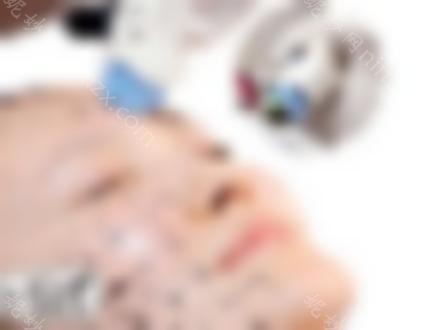 国产热玛吉和进口热玛吉有什么区别？教你一眼识别