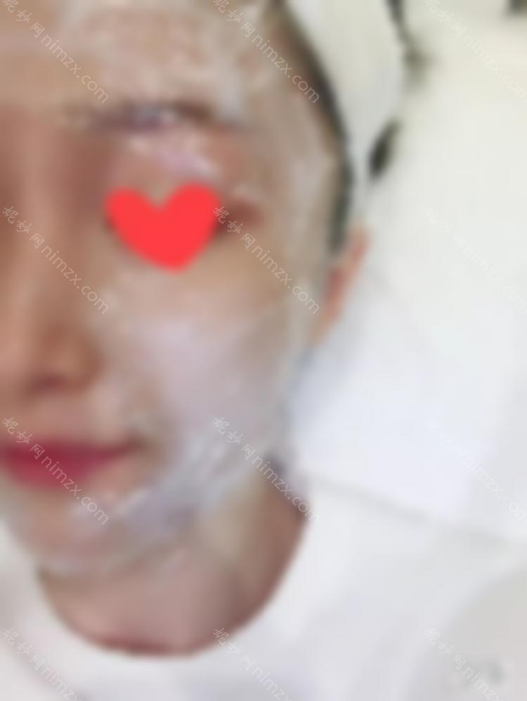 90之后，我已经开始做热玛吉了。让我们谈谈我个人的感受