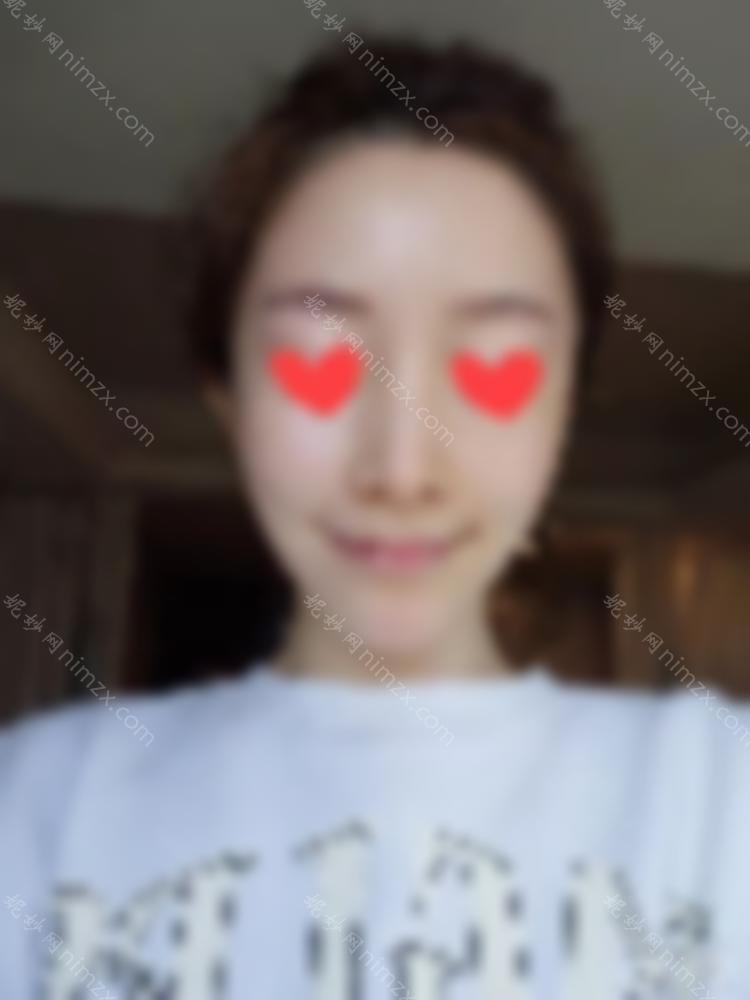 90之后，我已经开始做热玛吉了。让我们谈谈我个人的感受