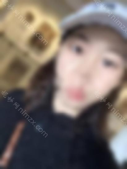 张冰洁医生双眼皮睁开眼角，眼睛瞬间变得有活力！