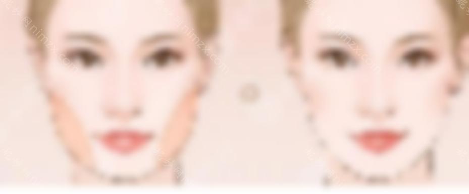 面部吸脂修复的五大步骤是什么？科普复颜回春美丽秘法！