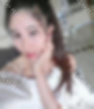 分享开眼角前后对比图效果图，并附上恢复全过程分析