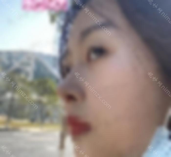 重医何光照隆鼻病例来袭：3个月后效果惊人！妈妈直呼认不出来