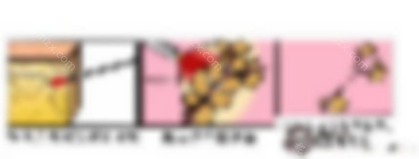 大连吸脂减肥的价格是多少？这个技术好吗？