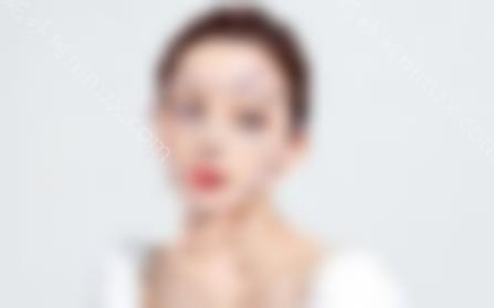 自体脂肪填充太阳穴的弊端有哪些？如何避免后遗症？