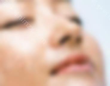 自体软骨隆鼻价格贵吗？术后可以随意揉捏鼻子吗？