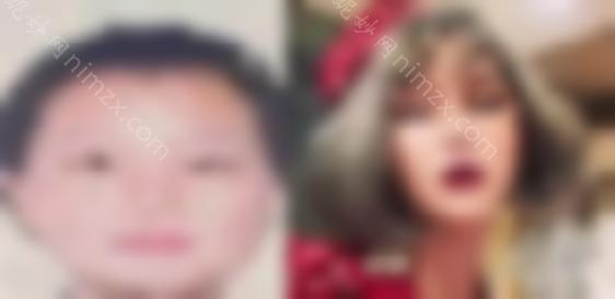 网红滕雨佳花50万做双眼皮修复手术！为什么双眼皮修复这么难？
