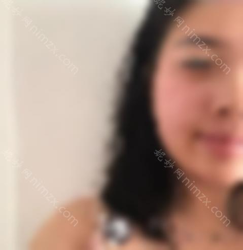 皮秒祛斑10天变化图片分享！分享我的个人过程！快来看看吧