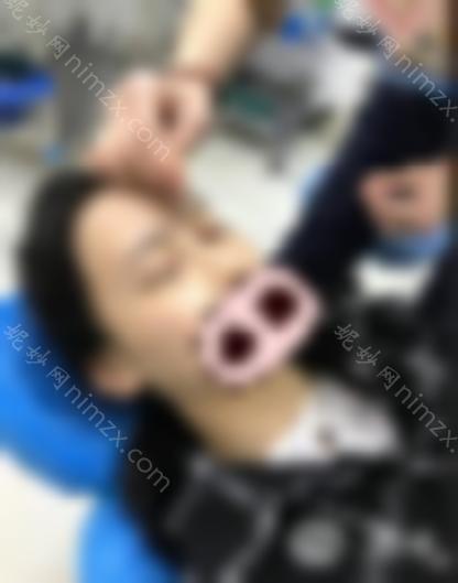 开眼角危险吗？真实开眼角案例分享(附图)