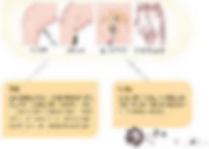 大腿内侧吸脂效果好吗？一次能瘦多少厘米？