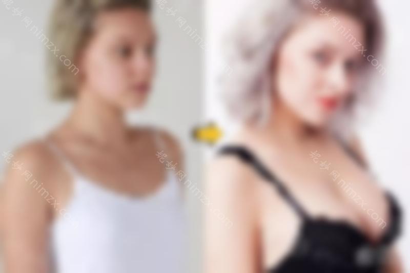 隆胸10年:重庆女性较喜欢的杯排名？答案很好open