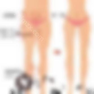 大腿内侧吸脂效果好吗？一次能瘦多少厘米？