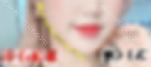 瘦脸*能定型多少次？术前需要特别注意什么？来看看吧