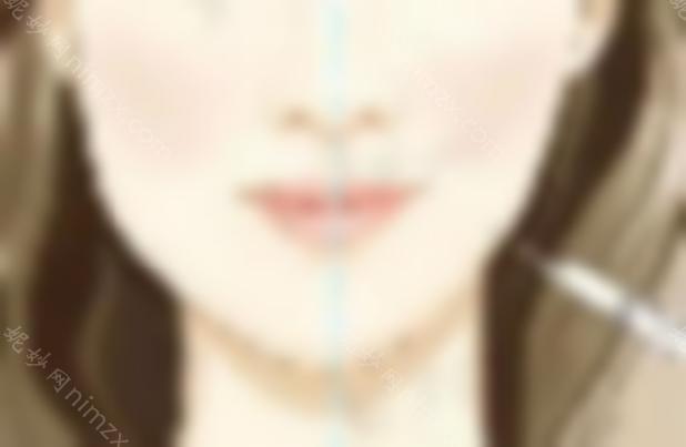 瘦脸*能定型多少次？术前需要特别注意什么？来看看吧
