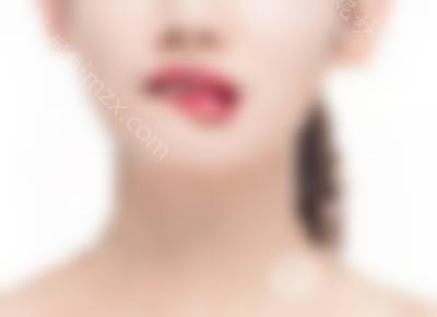 胶原蛋白丰唇有哪些优点？为什么要赢得大家的信任？
