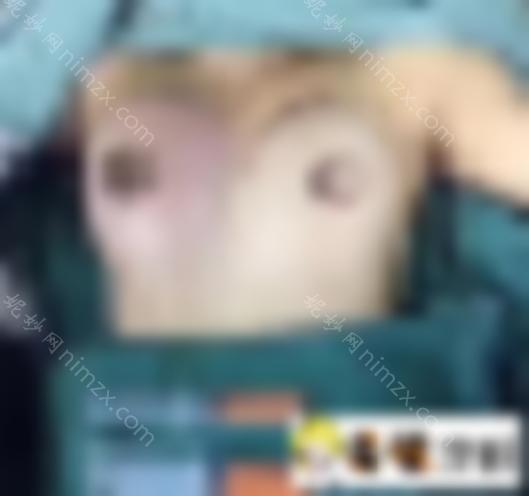 法国es分享假体隆胸记录~个人真实的手术经历是什么感觉？