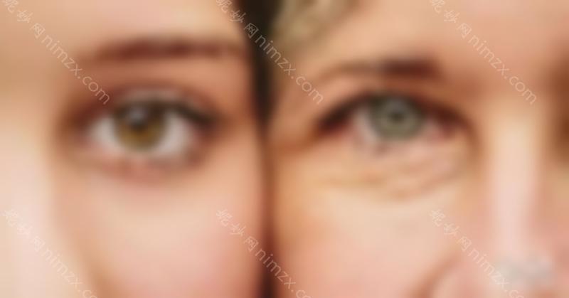 医美干货 | 你对切眉手术了解多少？