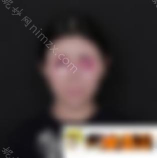 【美鼻日记】刘彦军360度假体隆鼻拍照无死角