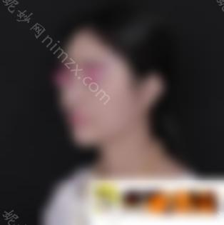 【美鼻日记】刘彦军360度假体隆鼻拍照无死角