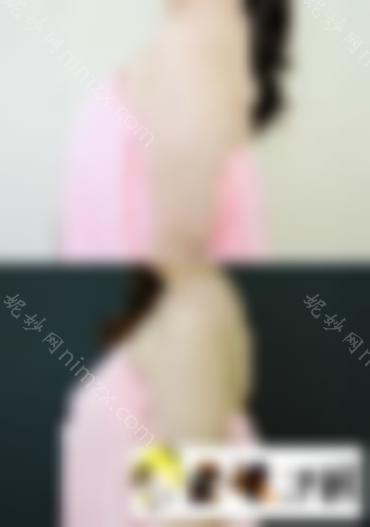 全身吸脂减肥手术吸脂减肥全身，回归少女身材