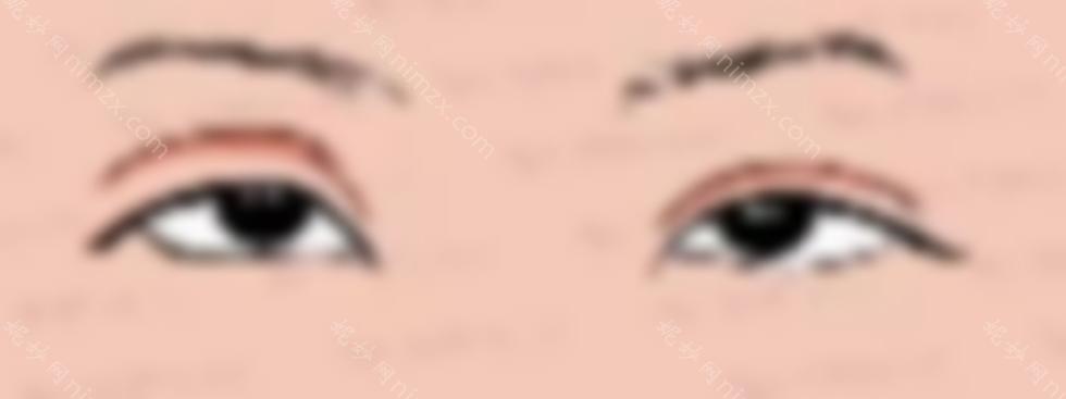 欧阳天祥双眼皮修复怎么样？医生综合实力介绍 欧阳天祥眼修复案例~