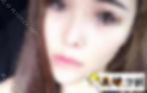 双美胶原蛋白注射丰唇效果怎么样？真人案例来喽！