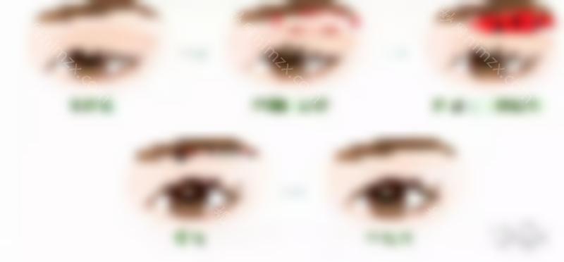 医美干货 | 你对切眉手术了解多少？