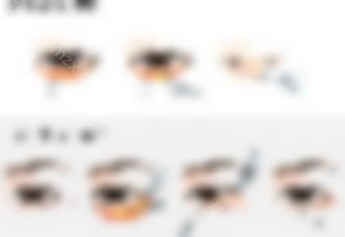 祛眼袋手术是怎样做的？术后会留疤吗？
