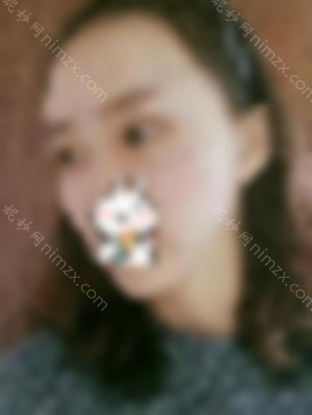 瘦脸*多久？注射瘦脸效果对比图，术后成为男神收割机！