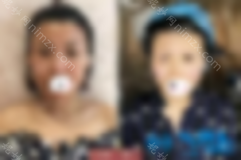 武汉天申整形医院面部埋线升级值不值 她的面值