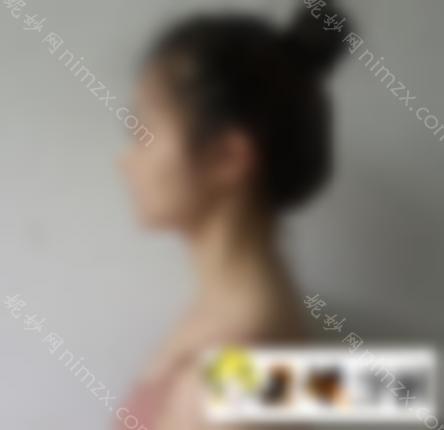 2021伊美尔价格公开，分享真正的隆鼻案例！