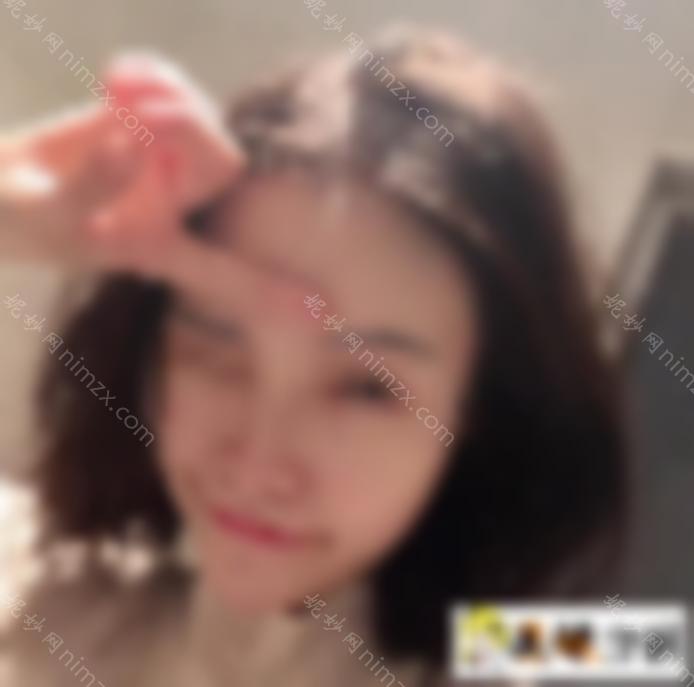 大脸怎么瘦脸？一定要做手术吗？