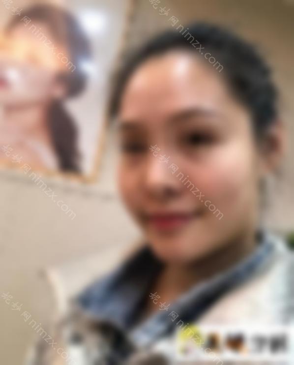 大脸怎么瘦脸？一定要做手术吗？