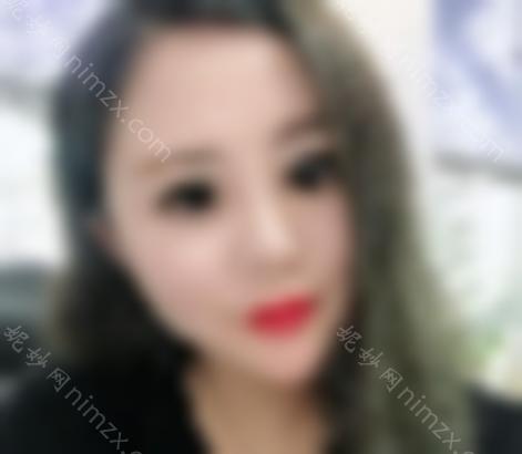 注射胶原蛋白填充唇部效果好吗？丰唇前后真实图例