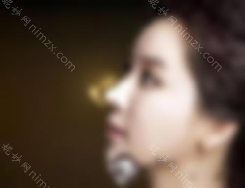 自体软骨隆鼻安全吗？如何提高手术的安全性和成功率？