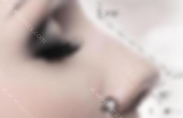 自体软骨隆鼻安全吗？如何提高手术的安全性和成功率？