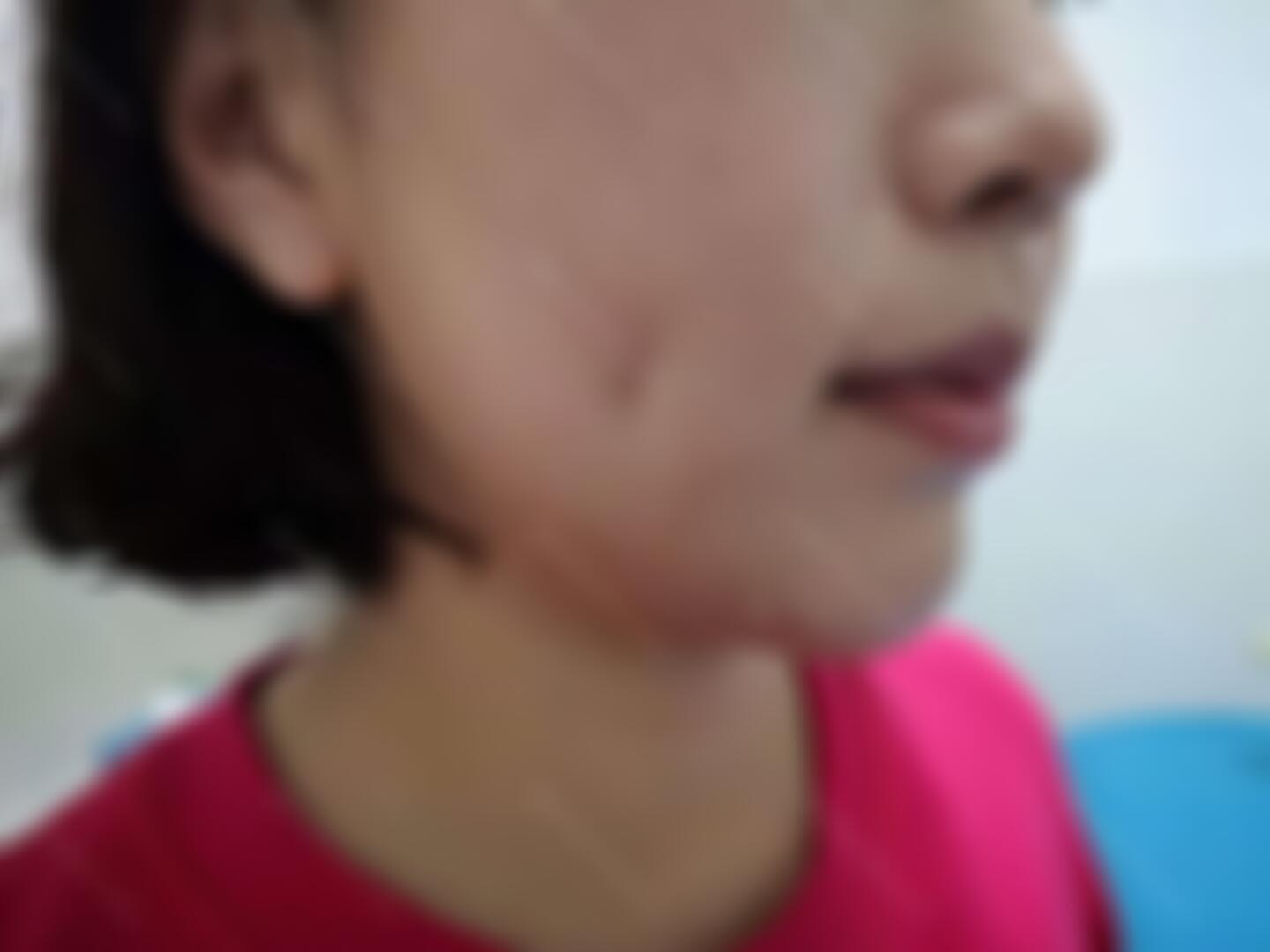 石家庄面容管家医疗美容门诊怎么样？