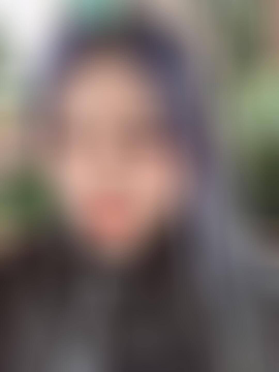 北京玉之光整形医院口碑好吗？