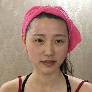 南京连天美美容医院医院口碑如何？