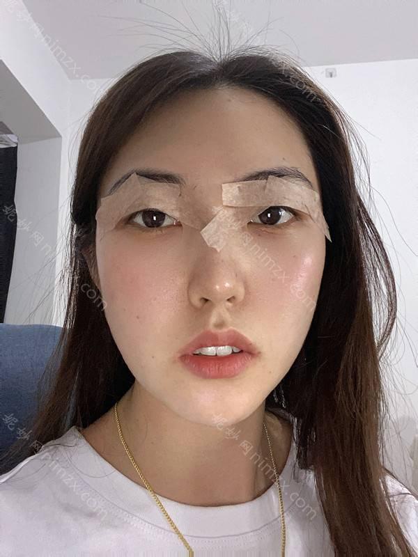 福州美莱华美美容医院医院口碑怎么样？