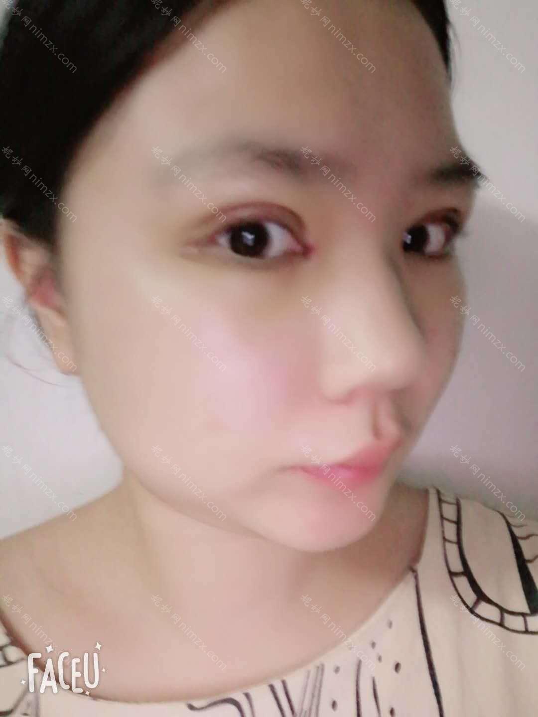 郑州华领医疗美容医院医院口碑怎么样？