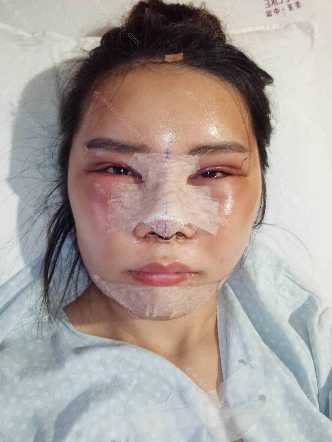 沈阳杏林整形外科医院怎么样靠谱吗?