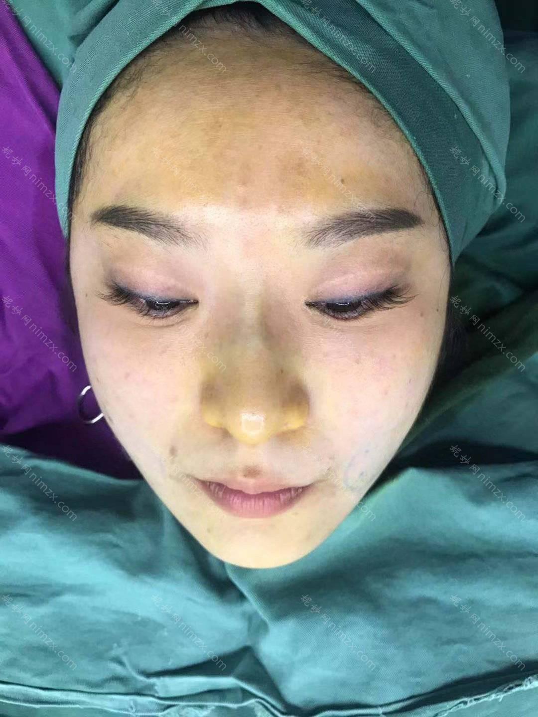 贵阳面部吸脂哪家医院好？这几家医院在贵阳都是比较有名的